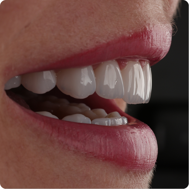 Resultado clínico Dr. Francis Lima