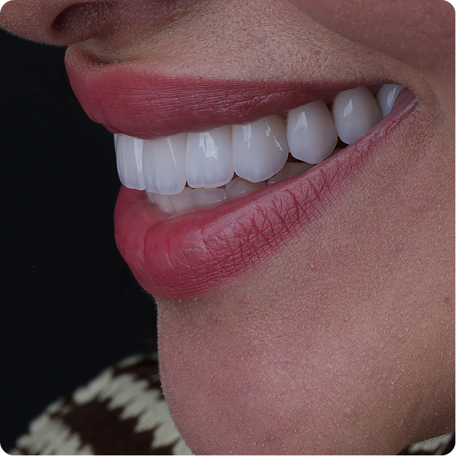 Resultado clínico Dr. Francis Lima