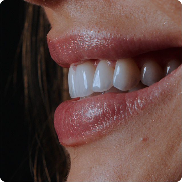 Resultado clínico Dr. Francis Lima