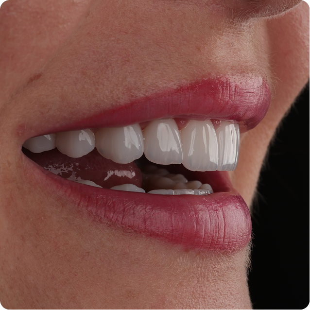 Resultado clínico Dr. Francis Lima