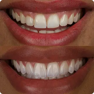 Resultado clínico Dr. Francis Lima