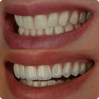 Resultado clínico Dr. Francis Lima