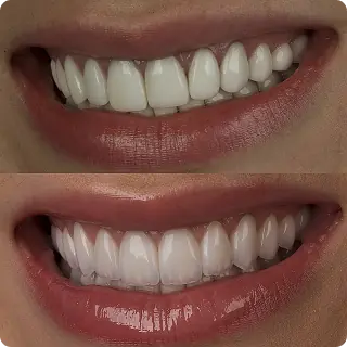 Resultado clínico Dr. Francis Lima