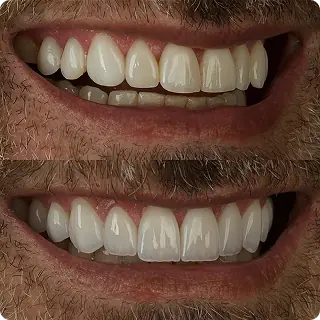 Resultado clínico Dr. Francis Lima