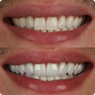 Resultado clínico Dr. Francis Lima