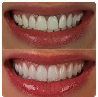 Resultado clínico Dr. Francis Lima