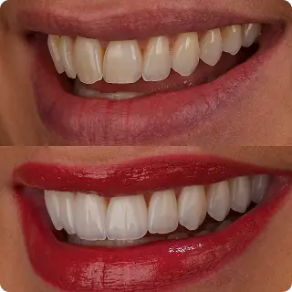 Resultado clínico Dr. Francis Lima